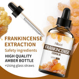 Load image into Gallery viewer, Frankincense Plant Essential Oil Face and Body Skin Care Essential Oil Moisturizing and Hydrating Massage Essential Oil